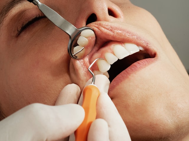 Klinika stomatologiczna – co może Ci zaoferować?